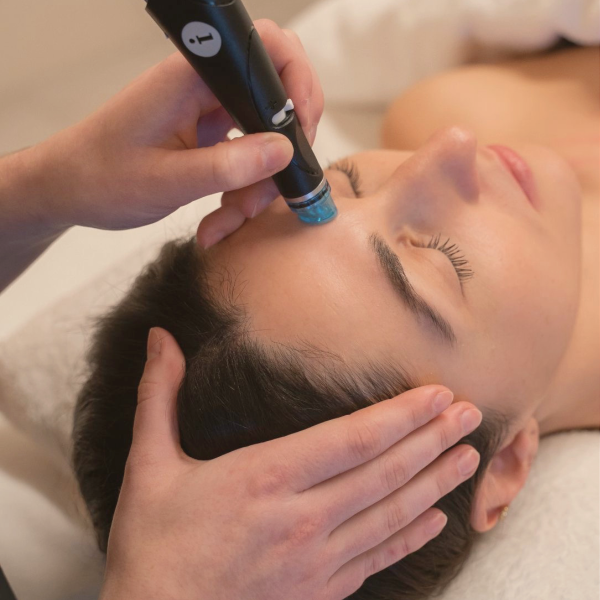 hydrafacial-hautbild